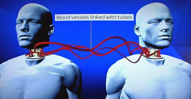 Chinese patients are the first to be grafted