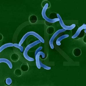 Cholera bacteria are more aggressive due to structural changes