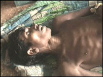 Cholera epidemic raging in eastern India