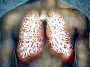 Chronic obstructive pulmonary disease, a world threat