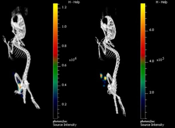 Close-up of the life-and-death battle inside the body
