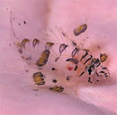 Close-up of the poisonous drama assassin causing extreme pain in the deep sea
