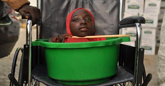 'Coconut Skull Girl' in Nigeria passed away on Christmas day