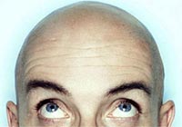 Coffee can cure baldness