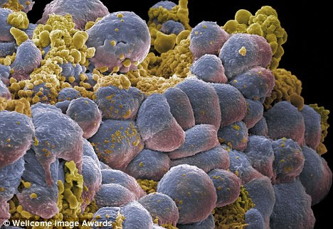 Coming soon bio-computers monitor people's health