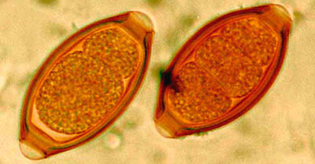Coming to the worm eggs will be an indispensable drug of humanity
