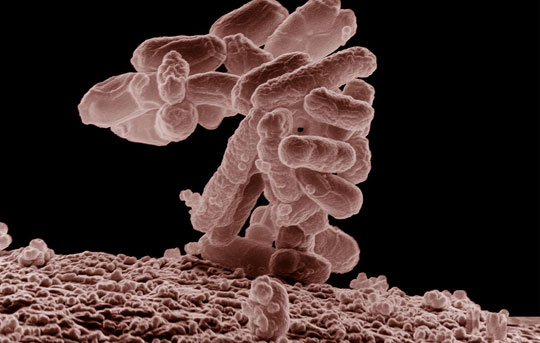 Concrete sealing bacteria