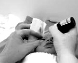 Conjunctivitis in newborns