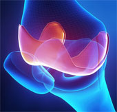 Control joint pain when changing seasons