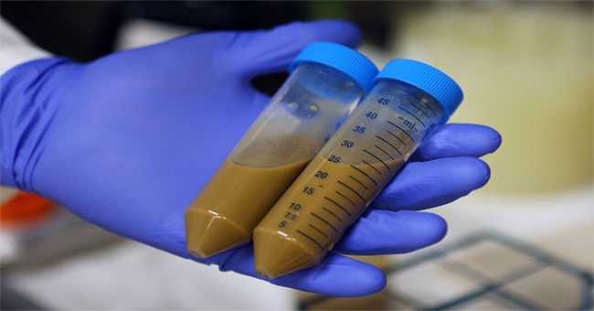 Controversy about a cure with human feces