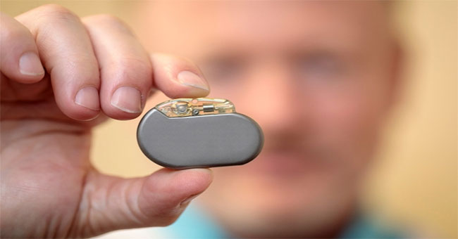 Create a kind of implant that increases sexual desire