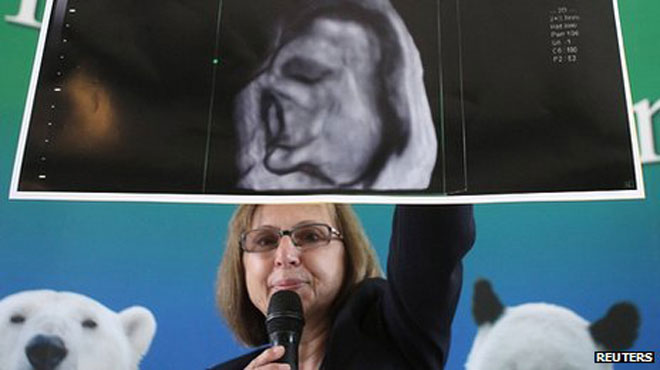 Create baby elephants from frozen sperm