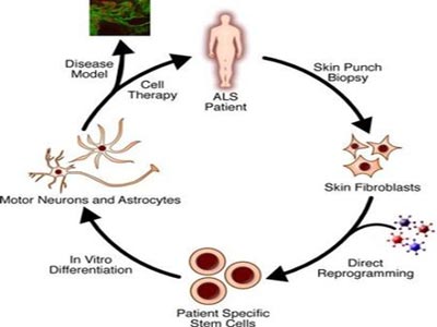 Create germ cells to treat 10 difficult to treat disorders