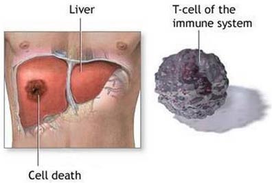 Create liver cells from subcutaneous fat