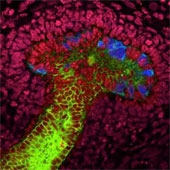 Create mini kidneys from stem cells