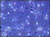 Create sperm from bone marrow