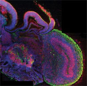 Create tiny brain from human skin