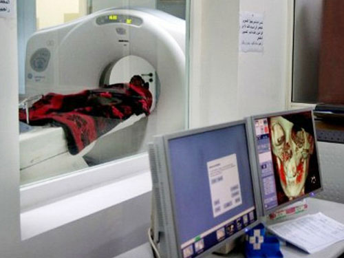 CT scan, children are at high risk of brain cancer