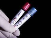 Cuba successfully abolished mother-to-child HIV infection