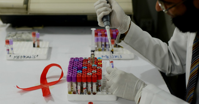Cuban researchers tested the HIV / AIDS vaccine