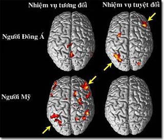 Culture affects brain activity