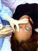 Cure acne and beauty by laser