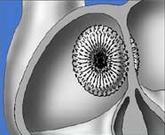 Da Nang: Treatment of congenital heart by advanced techniques