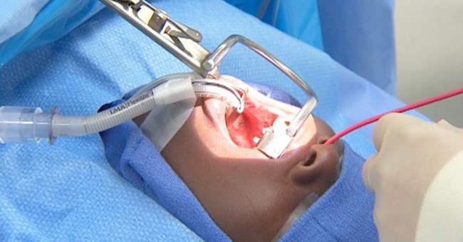 Dangerous complications can occur when tonsils are removed