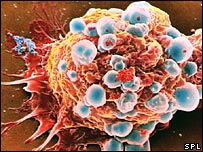 DCA molecule has the potential to help treat cancer