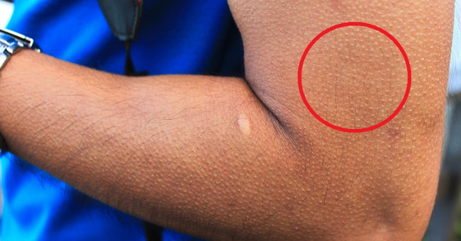 Decode goose bumps