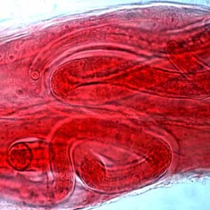 Decode helminth genes