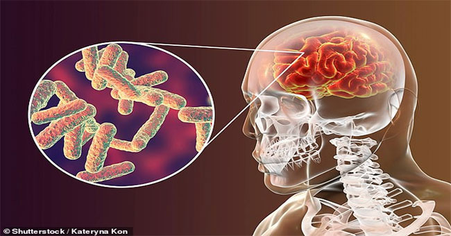 Decode misunderstandings about meningitis