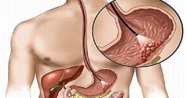 Decode the gene mutation to 'clean' the cancer cells