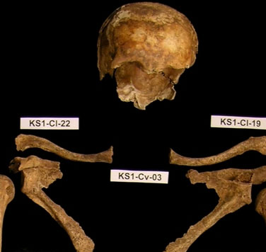 Decode the mystery of a mass grave in Germany