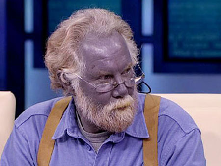 Decode the mystery of the blue skin