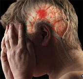 Decode the 'stroke shield' of the brain