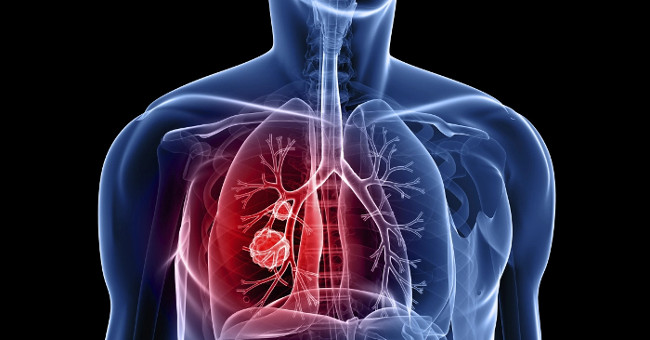Decoding why more and more people have cancer