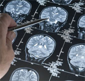 Delete painful memories thanks to genes that remove memory