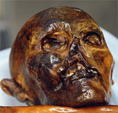 Dental examination for mummies