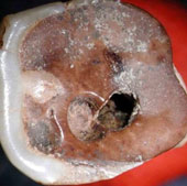 Dentistry was very developed from 9000 years ago