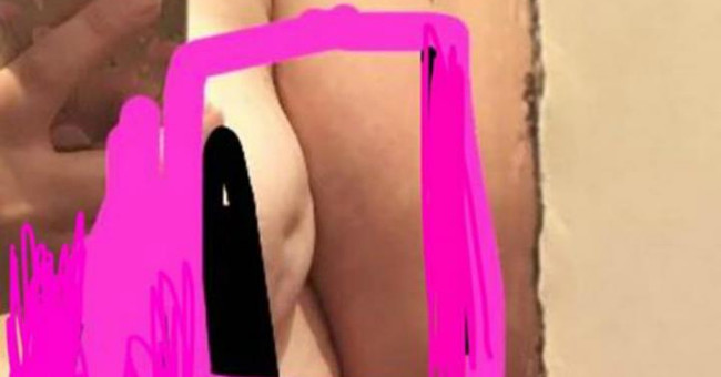 Dents on the chest warn of breast cancer