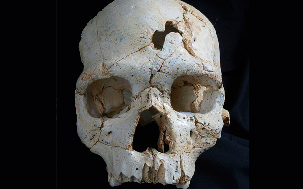 Detect the victim's skull in the first murder in the world