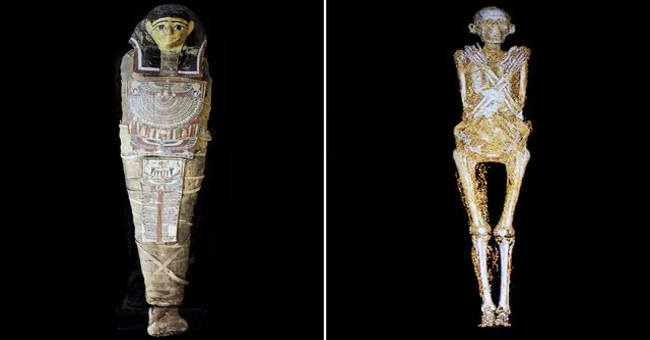 Detected 2,200-year-old mummy with obesity caused by eating a lot of sugar