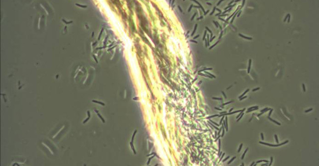 Detecting a bacterium that eats CO2