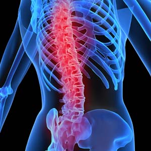 Detecting a mutant gene causes bone disorder