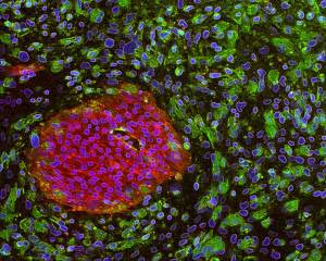 Detecting a new characteristic of embryonic stem cells
