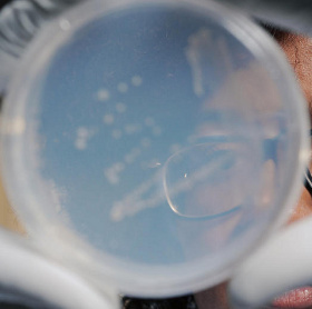 Detecting a significant amount of microorganisms in the troposphere