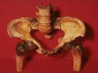 Detecting and treating osteomalacia