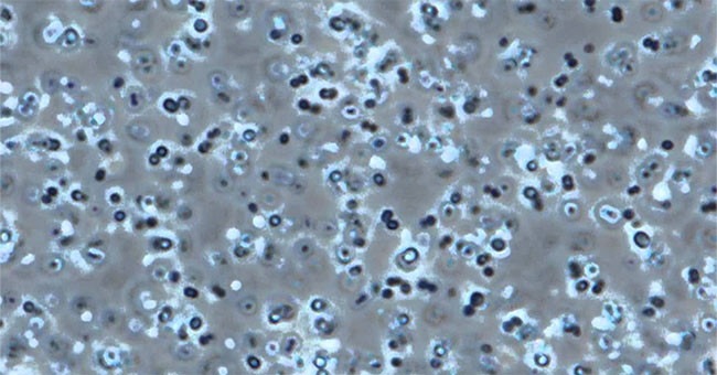 Detecting bacteria resistant to living conditions on Mars