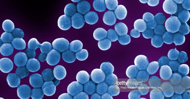 Detecting bacteria that live on the skin can prevent cancer